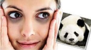 penyebab mata panda