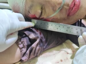 Ngeri, Tak Mau Dipisah, Clurit Pun Melayang