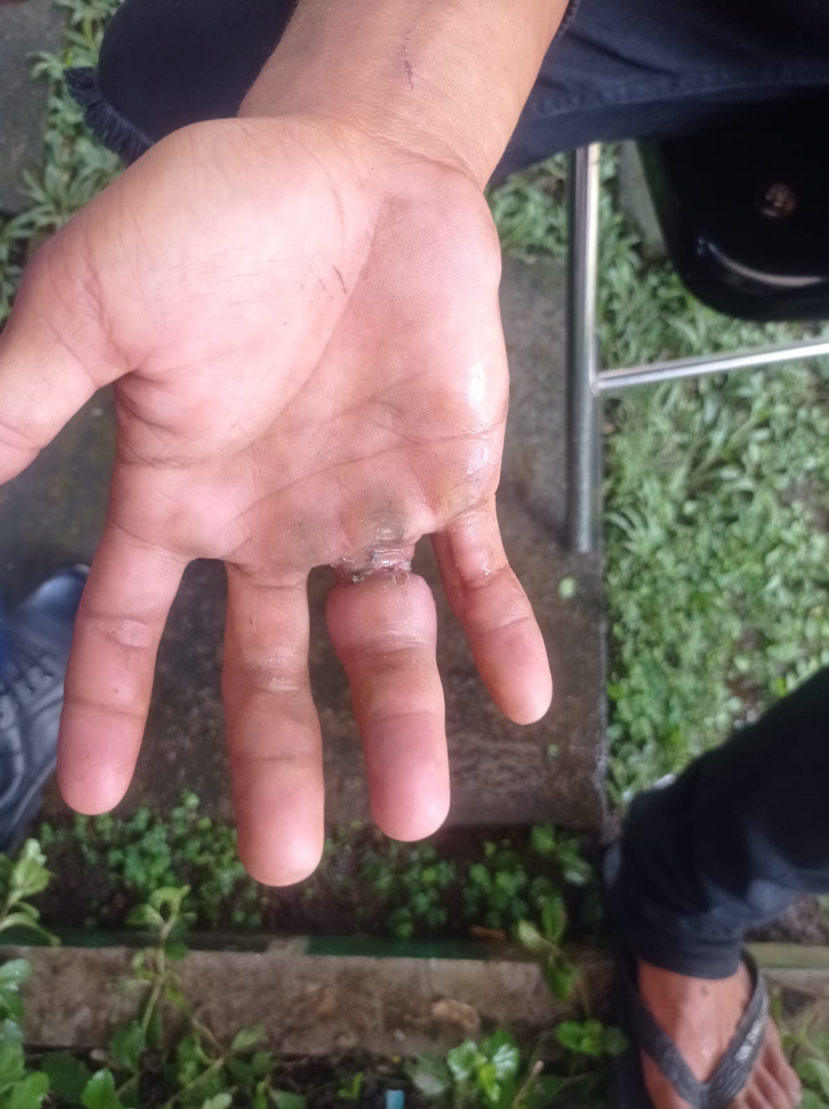 Cincin Yang Tidak Bisa dilepas