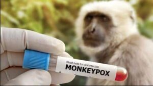 Dinas Kesehatan Banyuwangi, Waspada Cacar Monyet (Monkeypox)