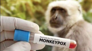 Dinas Kesehatan Banyuwangi, Waspada Cacar Monyet (Monkeypox)
