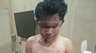 salah satu korban insiden pembacokan di cungking banyuwangi