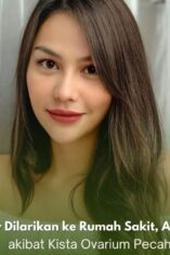 DJ Katty Butterfly dalam perawatan usai operasi kista ovarium pecah