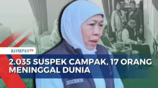 Dokter Internship Cianjur Meninggal Akibat Campak, Gubernur Desak Penanganan Komprehensif