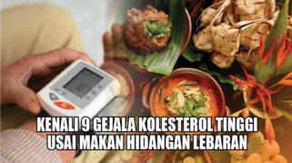 Lima Kebiasaan yang Memicu Kenaikan Kolesterol Usai Lebaran
