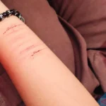 Insanul Fahmi Unggah Foto Tangan Berdarah, Suami Mawa Ikut Pamer Luka di Media Sosial