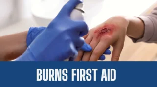 Ledakan SPBE di Bekasi, 18 Korban Luka Bakar Parah Diperiksa Rumah Sakit