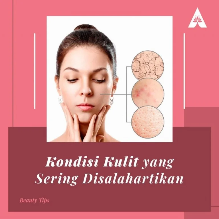 Masalah Khusus yang Sering Ditemui pada Kulit Berwarna