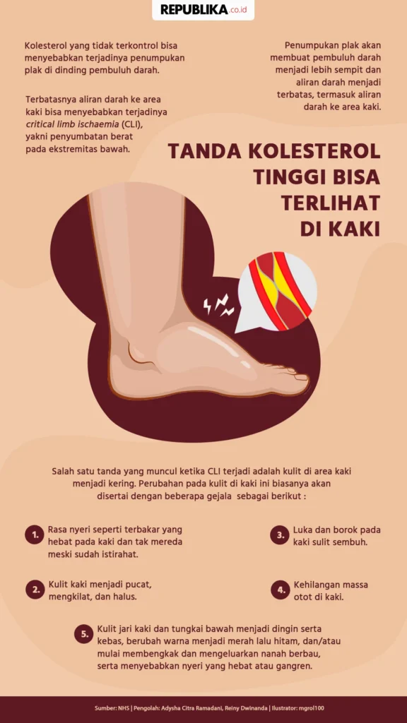 Memahami Tanda‑tanda Masalah Kaki yang Perlu Diperhatikan