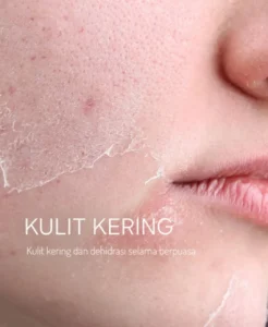 Pahami Tantangan Kulit Selama Puasa