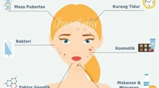 Penyebab Jerawat pada Remaja