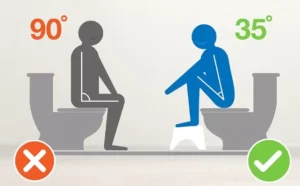 Posisi Jongkok yang Dianjurkan Saat Buang Hajat untuk Kesehatan Pencernaan