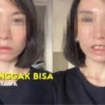 Wajah Kencang Karena Botox, Ratu Felisha Tersiksa Tak Bisa Tertawa Selama Syuting Film