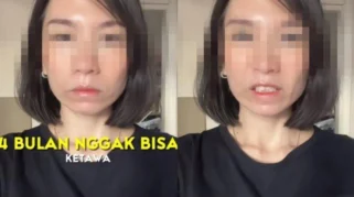 Wajah Kencang Karena Botox, Ratu Felisha Tersiksa Tak Bisa Tertawa Selama Syuting Film