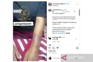 Andre Taulany Anjurkan Laporan Polisi dalam Kasus Penganiayaan ART Hera oleh Erin