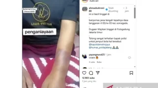 Andre Taulany Anjurkan Laporan Polisi dalam Kasus Penganiayaan ART Hera oleh Erin