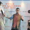 Ketua GSI Lumajang Dukung Penanganan Balita Down Syndrome dan Penyakit Jantung Bawaan