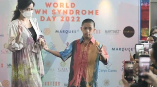 Ketua GSI Lumajang Dukung Penanganan Balita Down Syndrome dan Penyakit Jantung Bawaan
