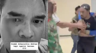 Kondisi Terkini Bro Ron Usai Luka Parah di Pelipis Setelah Dipukuli Preman di Menteng