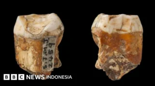 Neanderthal Diduga Melakukan Operasi Gigi 59 Ribu Tahun Lalu di Siberia