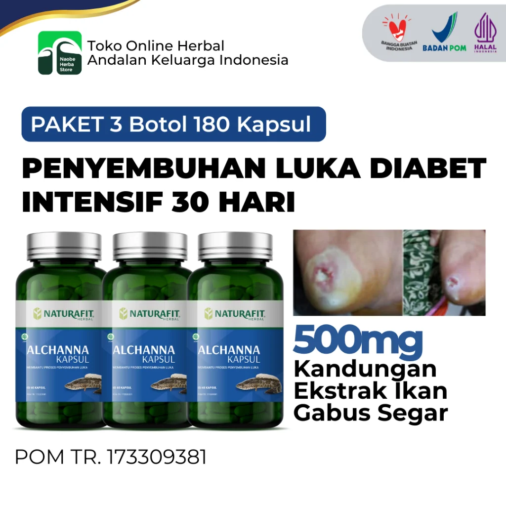 Rangkuman Praktis untuk Mempercepat Penyembuhan Luka pada Diabetes