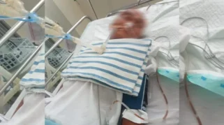Hasil Otopsi Bidan Korban Dugaan Pembunuhan: Meninggal karena Benda Tumpul di Kepala