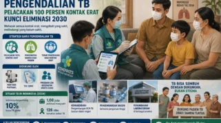 Kemenkes Ubah Strategi Pengendalian Tuberkulosis, Wajibkan Tracing 100 Persen Kontak Erat