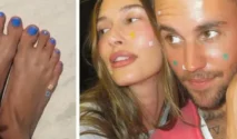 Mengapa Hailey Bieber Mengenakan Patch Jerawat di Kakinya
