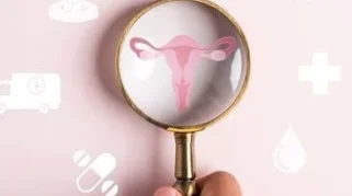 Mengenal IVA Test, Pemeriksaan Deteksi Dini Kanker Serviks