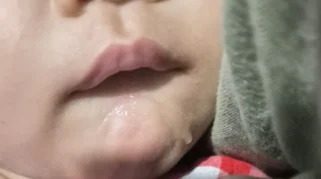 Mitos Bayi Ngeces Akibat Keinginan Ibu Hamil Tak Terpenuhi, Ini Faktanya