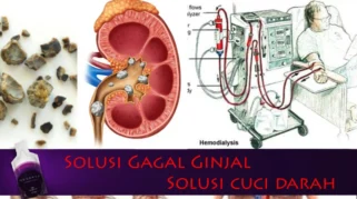 Trisno PAS Band Alami Gagal Ginjal dan Operasi Sumbatan Darah di Kepala