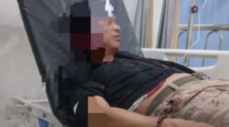 Duel Berdarah di 16 Ilir Palembang, Pria Asal Banyuasin Ditusuk Berkali-kali hingga Kritis