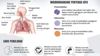 Lima Cara Efektif Mencegah ISPA saat Musim Kemarau