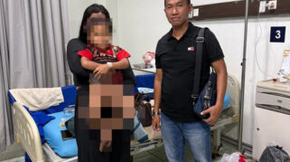 Bupati Karawang Bantu Biaya Pengobatan Balita Korban Kekerasan